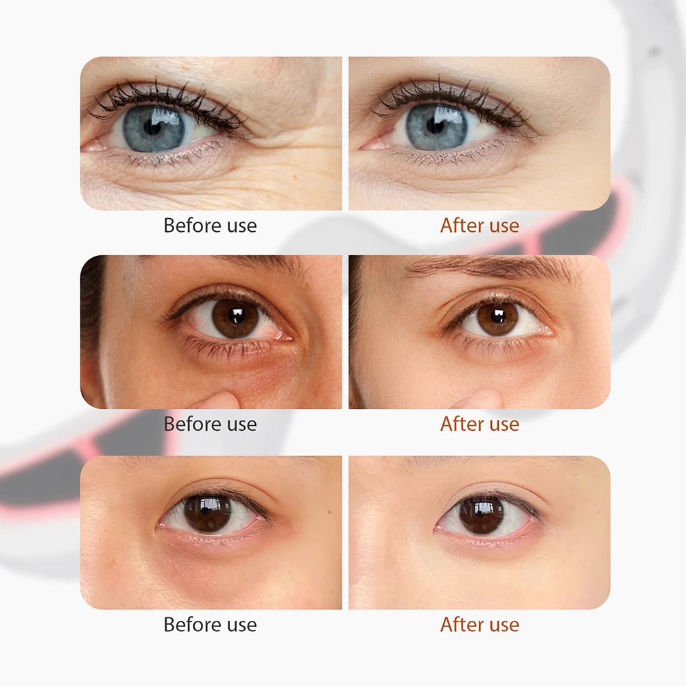 Foreverlily EMS Eye Massager Glasses for Eye Fatigue Relief