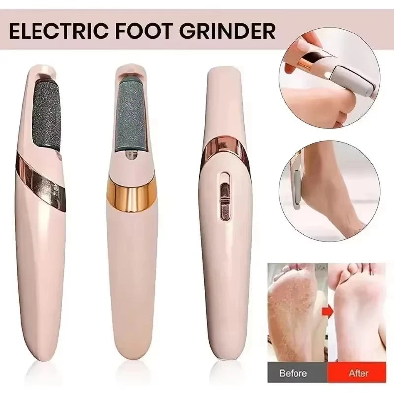 CalluEase Electric Foot Remover
