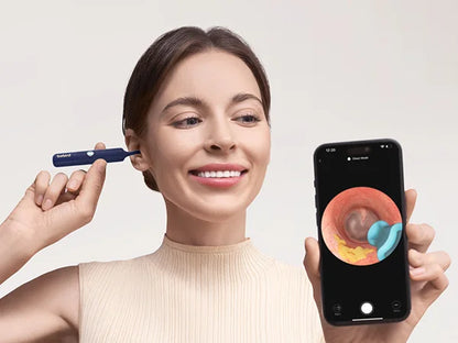 Visual Ear Wax Remover