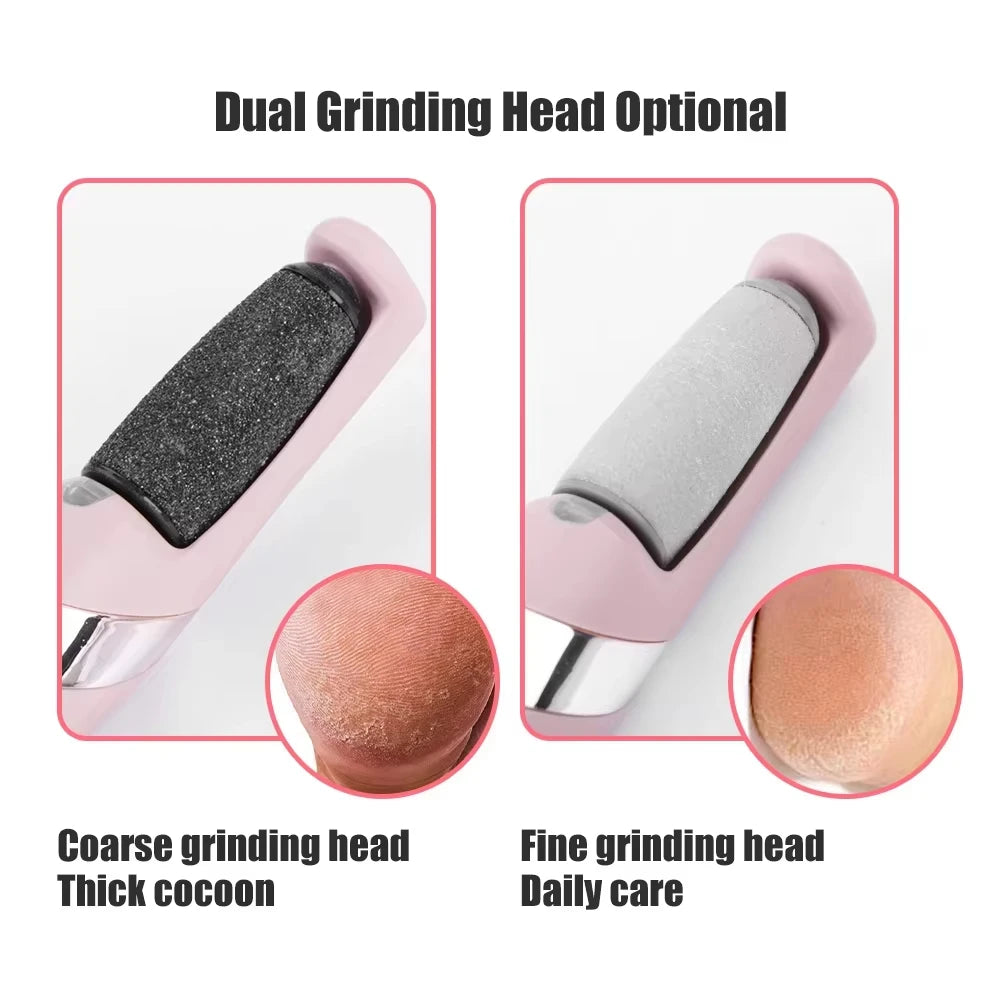 CalluEase Electric Foot Remover
