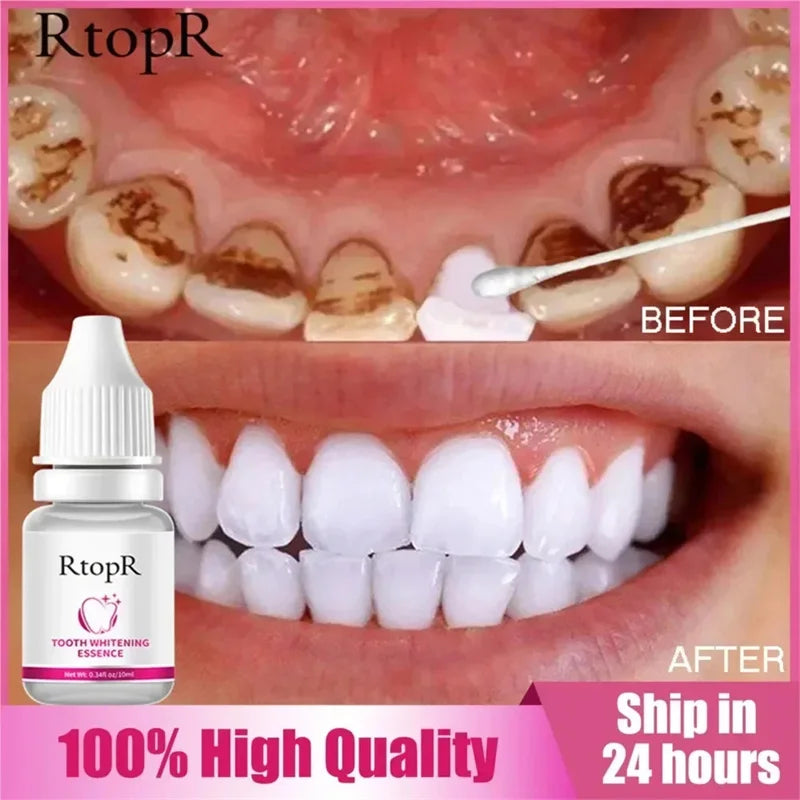 Dental Calculus Remover Toothpaste for Whitening