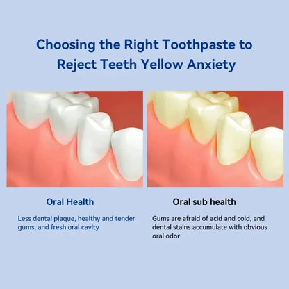 Dental Calculus Remover Toothpaste for Whitening