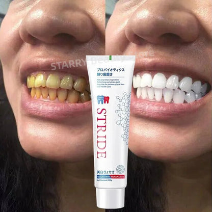 Dental Calculus Remover Toothpaste for Whitening