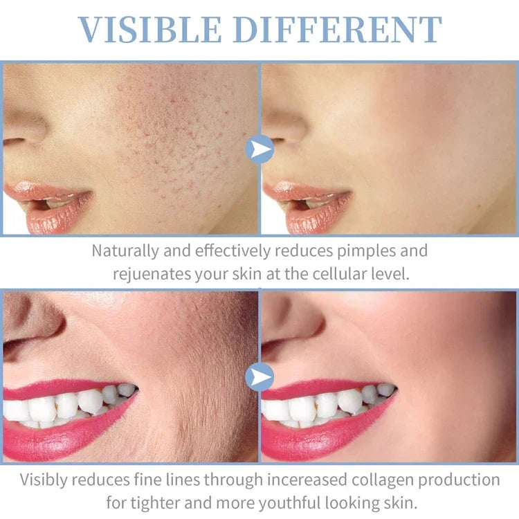 4-in-1 High Frequency Facial Wand