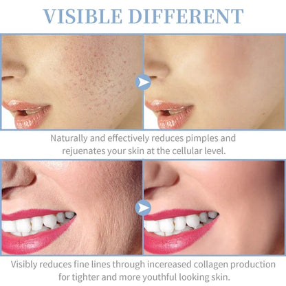 4-in-1 High Frequency Facial Wand