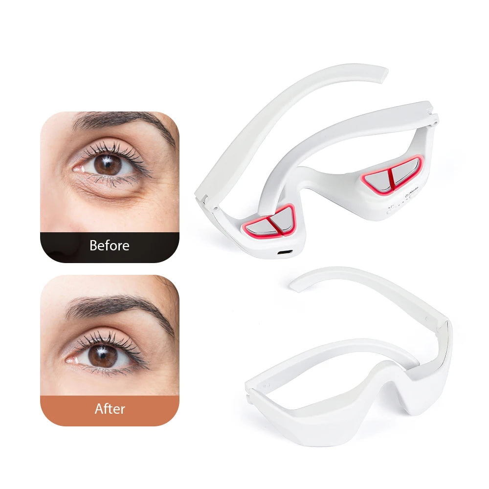 3D Eye Massager – Relaxing Dark Circle & Smooth Eye Therapy Device
